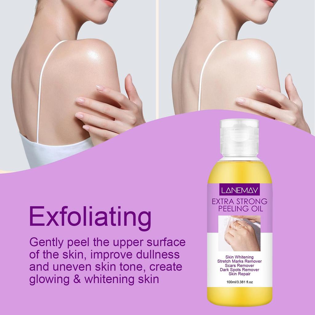 Extra Strong Peeling Oil-Skin Whitening & Repair-Remove Stretch Marks And Scars-Suitable for all Skin Types, 100ml