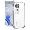 Necklace Crossbody Lanyard With Strap Case For Vivo V40 Pro V40 SE V40 Lite Shockproof Transparent Soft Cord Phone Cover Fundas