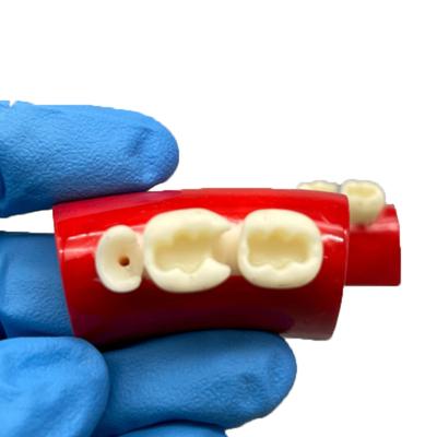 1 pièce modèle de remplissage buccal modèle d'exercice d'incrustation dentaire bloc de remplissage exercice Typodont matériaux en résine pour enseignement de la dentisterie