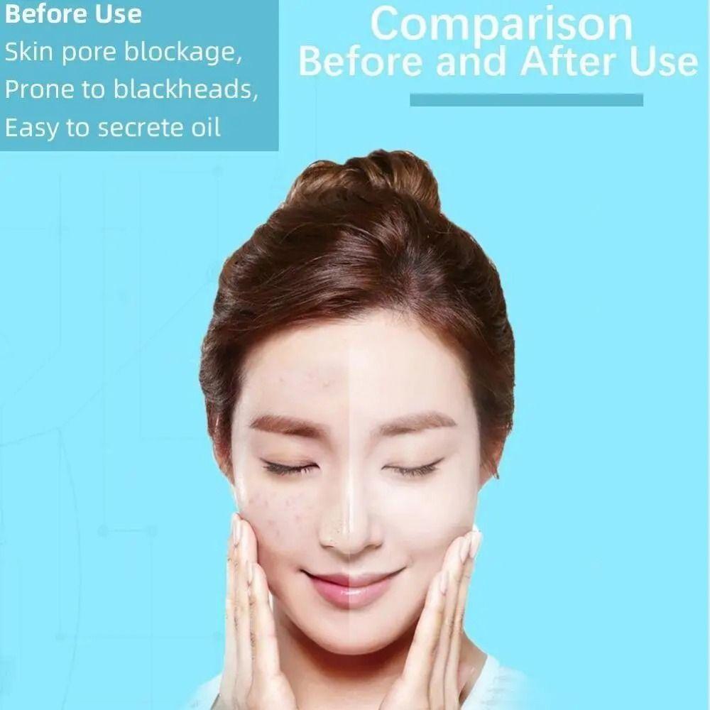 Water Cycle Blackhead Remover Electric Tool Acne Cleaner Pore Cleaner Pore Treatment