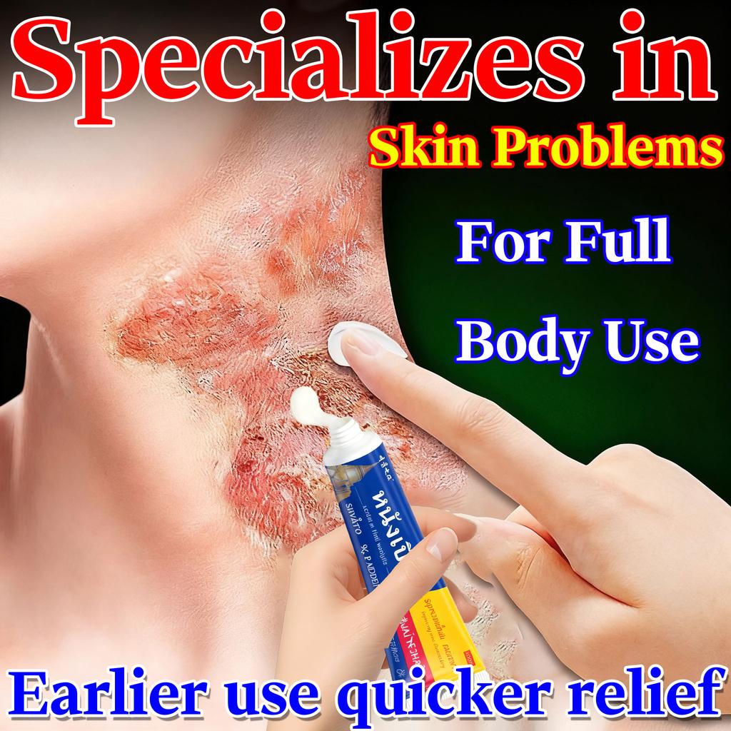 Herbal Skin Issue Relief Cream - Eases Eczema Dermatitis & Skin Discomfort