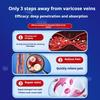 Varicose veins cold compress gel special plaster red blood swelling blue veins bulging earthworm legs dredging blocked blood vessels