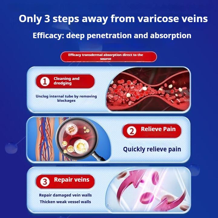 Varicose veins cold compress gel special plaster red blood swelling blue veins bulging earthworm legs dredging blocked blood vessels