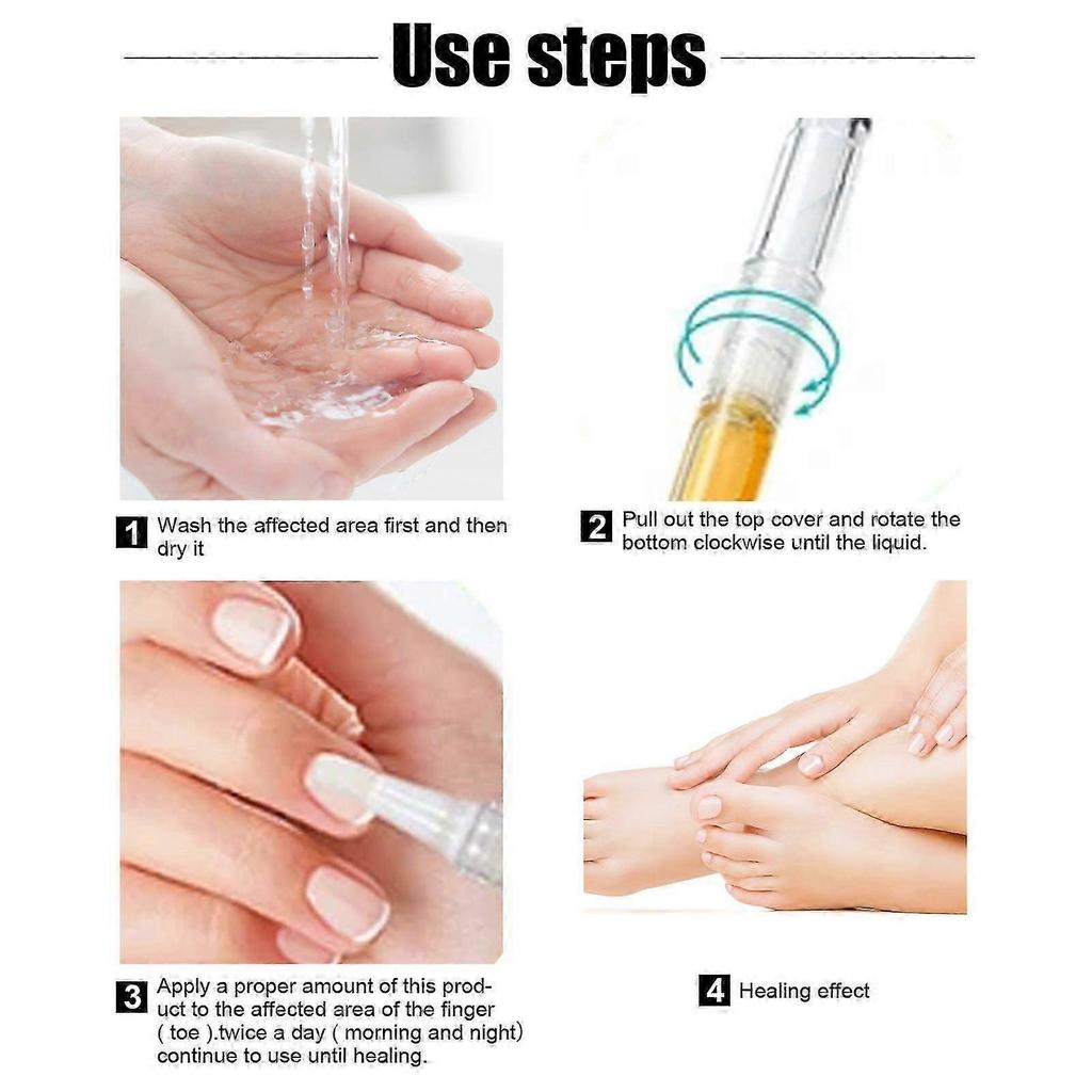 Exstroyeza Nail Repair Pen - Fungal Treatment & Nourishing Solution for Healthy, Clear Nails On Hands & Feet - 5ml Portable Nail Care for Bacterial In