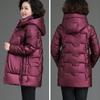 Winter Women's Shiny No-wash Padded Jacket   Mid-length Hooded Padded Coat