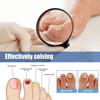 Tånagelsvampsplåster, Nattnagelvårdsplåster, Snabba nagelvårdsplåster, Minska Onychomycosis Och Mjuka Naglar (32 st/kartong) 2 st
