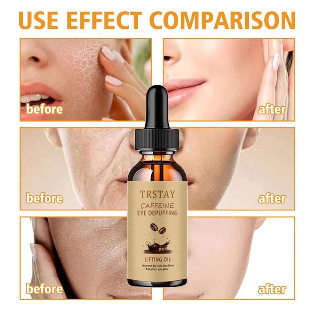 Aufhellende Creme zum Entfernen dunkler Flecken, Gesichtscreme gegen Sommersprossen, Creme zum Entfernen von Melasma und dunklen Flecken, aufhellende Creme zum Entferner