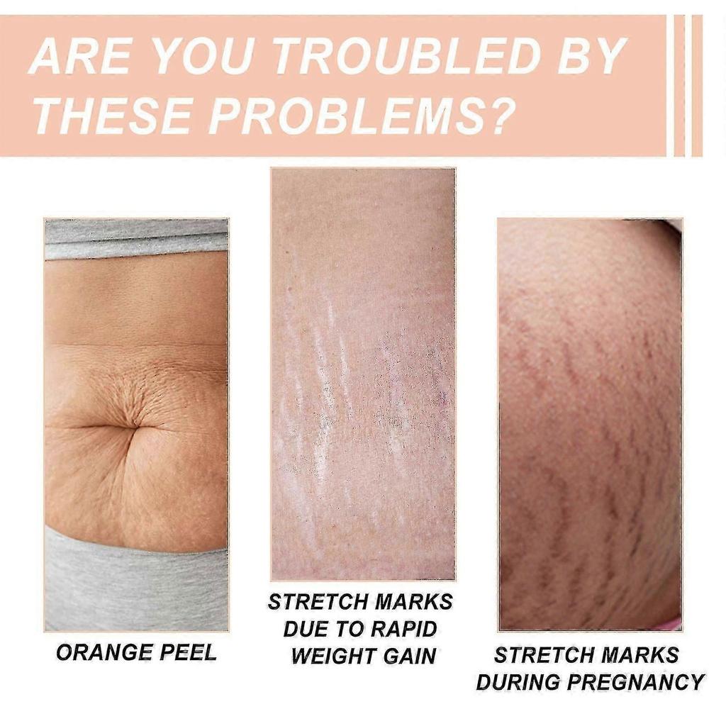 Wiieey Snail Essence Pregnancy Cream Firming Skin Repair Fading Postpartum Pregnancy Marks Pregnancy Obesity Wrinkle Cream Lotion & Moisturizer1pcs) -