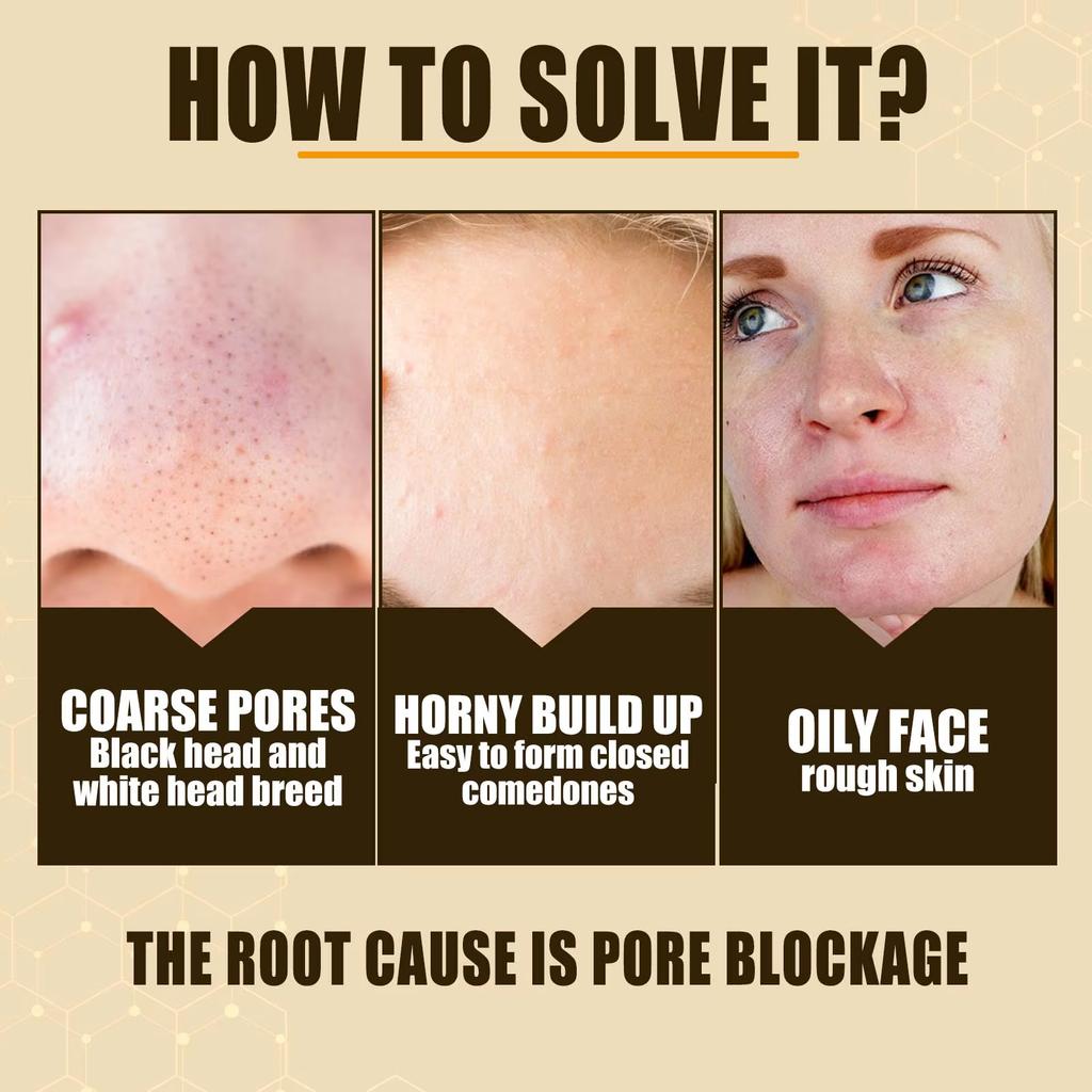 Lactobionic Acid Face Serum Pore Shrink Hyaluronic Acid Moisturizing Nourishing Firming Brighten Beauty Korean Cosmetics