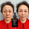 SKIN CARE Soomiig Instant Remove Wrinkles Retinol Face Cream Lifting Anti Aging Anti Eye Bags Moisturizer Facial Treatment Korean Care
