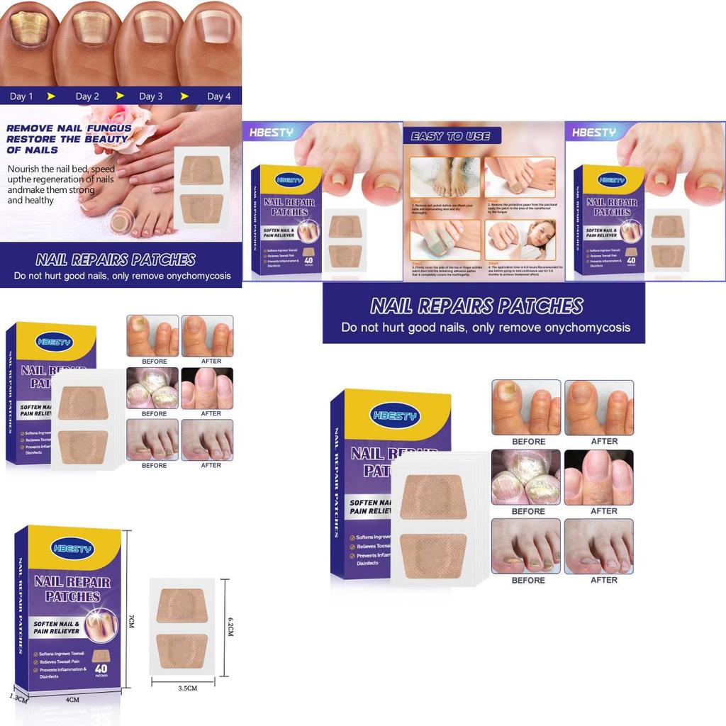 Hbesty Toenail Repair Patches For Damaged Soft Nails With Herbal Scented Comfort 40 Count
