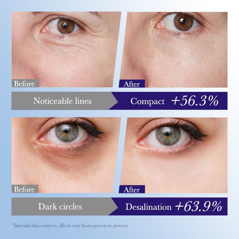 20G Sadoer Nachtkerzen Augencreme Gegen Dunkle Ringe Tränensäcke Entferner Anti-Aging Feuchtigkeitsspendend Augen Hautpflege Kosmetik