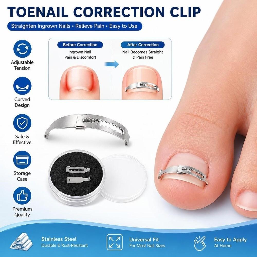 2PCS Stainless Ingrown Toenail Corrector Curved Design Curved Toenail Repair Tool  Nail Correction