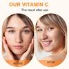 STYLEFLOW Vitamin C Face Serum with Hyaluronic Acid & Vitamin E | Brightening, Hydrating, Anti-Aging, Dark Spot & Acne Mark Removal | For Glowing