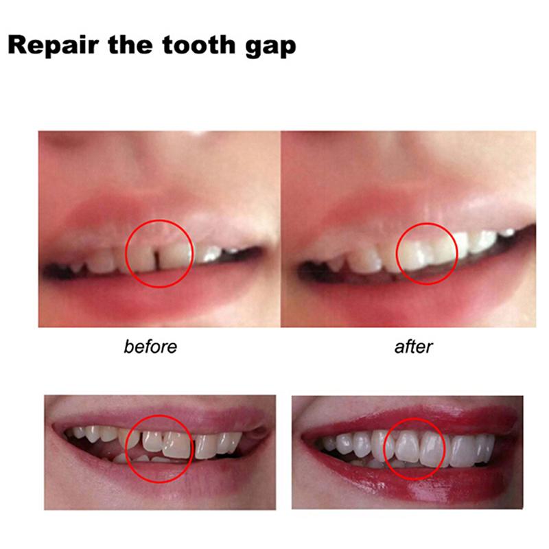 Temporary Tooth Repair Kit Teeth And Gaps False Teeth Solid Glue Denture Adhesive Teeth Whitening Tooth Beauty