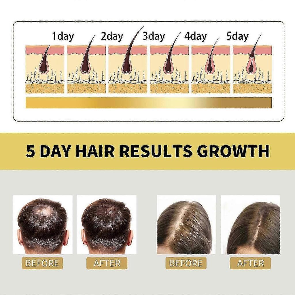 Ingwer-Shampoo für Haarwachstum & Reparatur - Natürlich, Gegen Haarausfall, Geeignet für