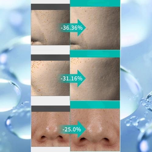 SHIONLE Laminaria Kelp Ampoule Cleansing Foam 120ml [Deep Pore Cleanser/HWAHAE Cleansing Foam Winner]