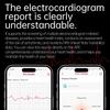 2025 New Uric Acid Blood Lipids Smart Watch Men ECG+PPG Blood Pressure Blood Oxygen Bluetooth Call Health Smartwatchs for IOS Android