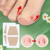 Nail Fungus Treatment Patches, Repairing and Improving Appearance of Damaged, Discolored, and Thick Nails, Toenail Fungus Removal Tools