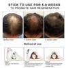 Dimollaure Huile de Croissance Capillaire Améliorer la Chute de Cheveux Croissance Cheveux Épais Essence Soin du Cuir Chevelu