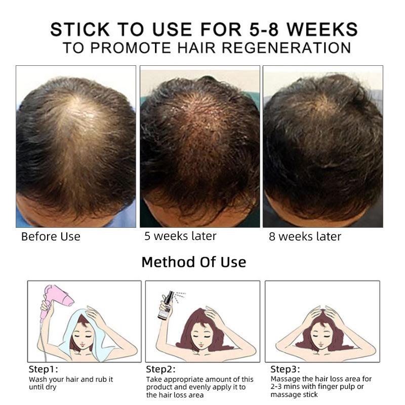 Dimollaure Huile de Croissance Capillaire Améliorer la Chute de Cheveux Croissance Cheveux Épais Essence Soin du Cuir Chevelu