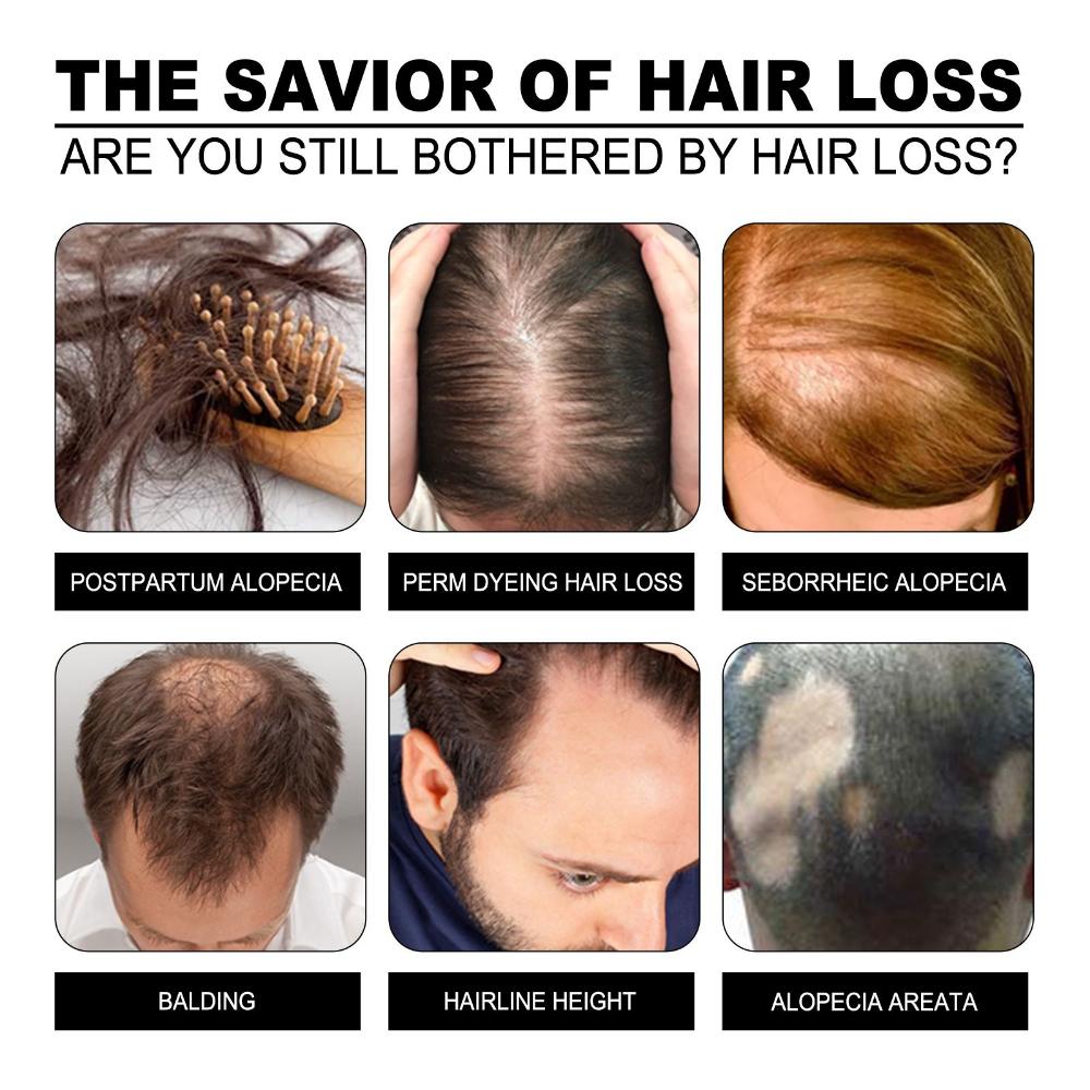 Růst vlasů Péče o vlasy Vyživující vlasy Sérum s fermentovanou rýžovou vodou s esenciálním olejem Oprava poškozených vlasů