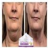 Neck Cream Anti-Wrinkle Whitening Moisturizing+ Firming Cream Anti-Aging Cream for Neck