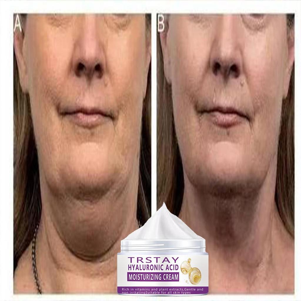 Neck Cream Anti-Wrinkle Whitening Moisturizing+ Firming Cream Anti-Aging Cream for Neck