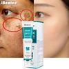 Whitening and Freckle Removing Cream Fading and Gentle Freckles Removing Freckle Age Freckle Melasma Repair Cream