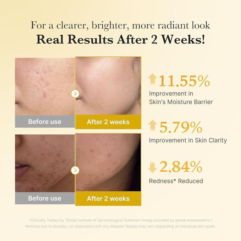 Medicube Kojisäure Kurkuma Niacinamid Serum 30ml