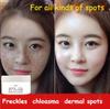 377 Whitening Cream VC Cream Freckles Chloasma Senile Plaques Beauty Salons Yellowing Cream Control Cream
