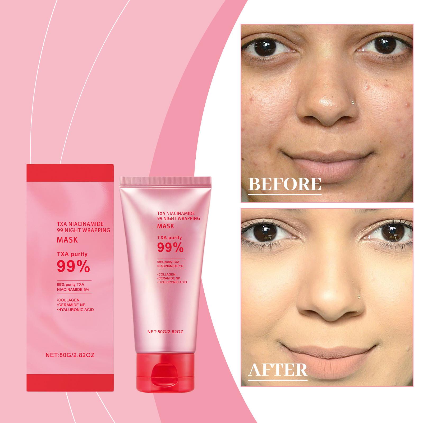 

Nicotinamide Tear Off Facial Mask, Gently Exfoliate, Deeply Moisturize, Firm Skin, And Improve Roughness,1pc,80g One Size розовый