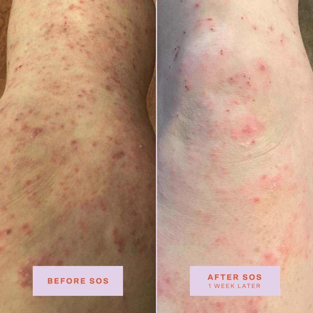 Tower 28 Beauty Sos Daily Rescue Facial Spray Jumbo Refill