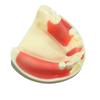 Dental Model Dentistry Implant Practice Training Model For Cutting Implant And Suturing Practice with Cancellous Bone Dental Lab