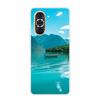 For Huawei Nova 10 Case 10Pro Clear Marble Soft TPU Silicone Back Cover For Huawei Nova 10 Pro Phone Case Funda Coque Nova10 Pro