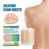 Silicone Scar Patch Waterproof Breathable and Soft For Postoperative Scars Burn Scars Acne Scar Daily Care Enhancing Skin Repair