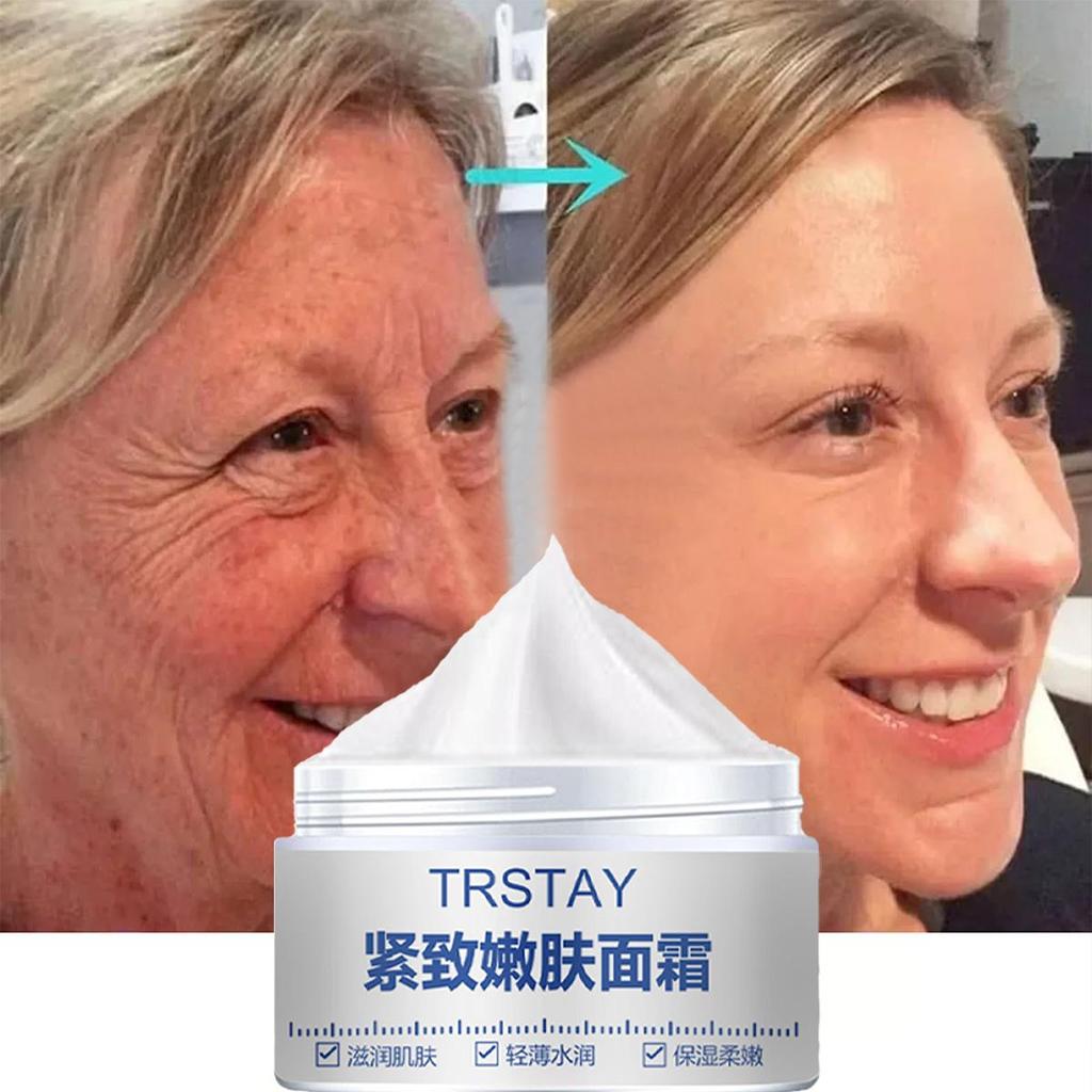 TRSTAY Moisturizing Cream, Vitamin C Brightening Face Cream, Brightening Skin And Lightening Spots