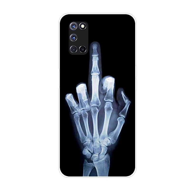 For Coque OPPO A52 Case A 52 Cute Painting Soft TPU Silicon Back Cover For OPPO A72 2020 A 72 Phone Cases For OPPO A52 A92 Capa