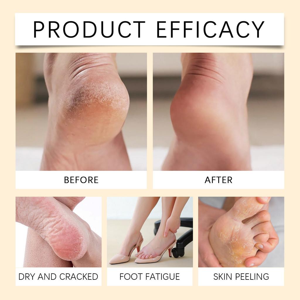 Houkea Exquisite Foot Exfoliating Spray For Gentle Cleansing And Softening Skin
