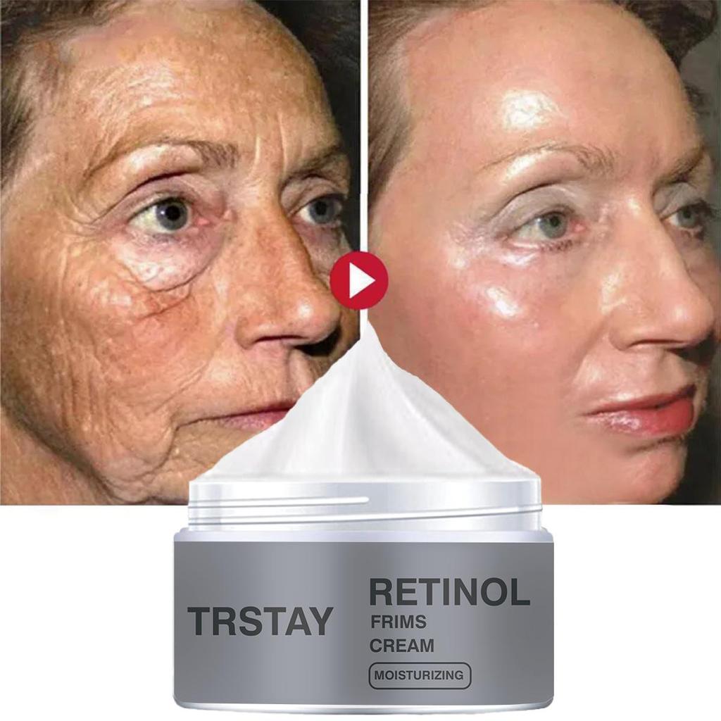 Retinol Collagen Moisturizing Face Cream, Mild and Non Irritating, Moisturizes and Moisturizes the Skin