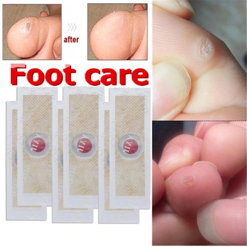 

Полезное медицинское лечение для рук кукурузы мертвой кожи Удаления патчи Освобождение пузыри