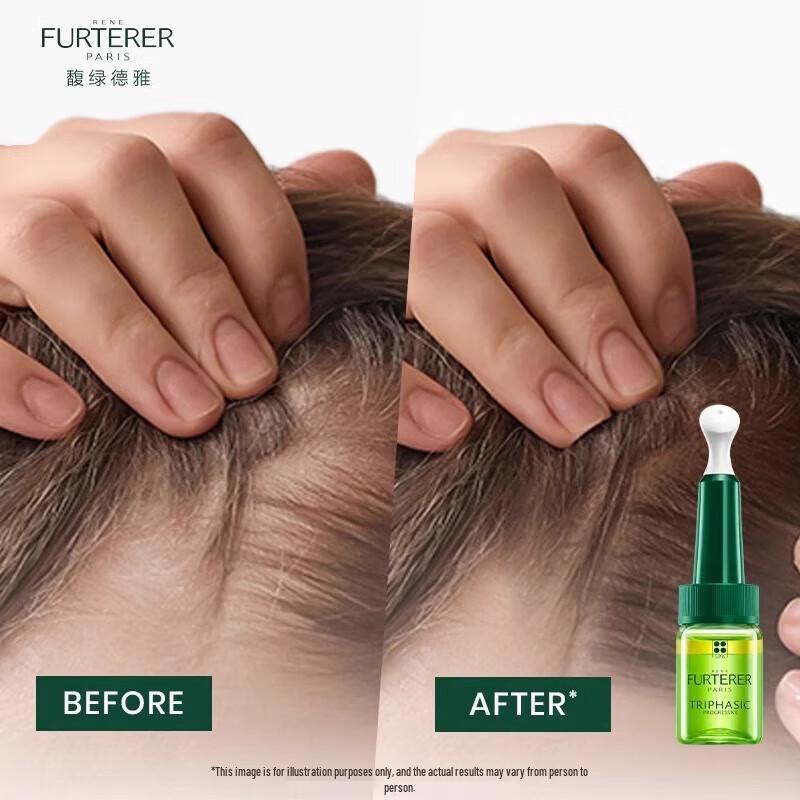 L'Oreal Herren Öl-Kontrolle Reiniger & Haarwachstumsessenz Set