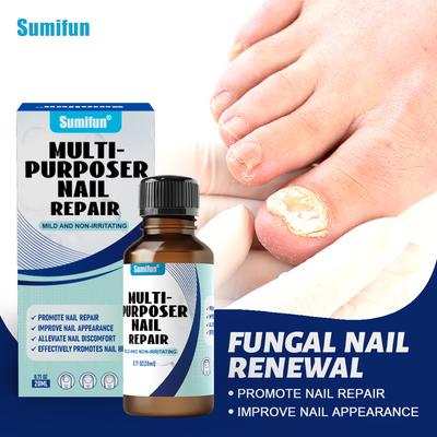 Gray Nail Paste, Thickened Shiny Nail, Gray Nail Repairs, Clean and Soft Nail Paste, Care for Hand, Foot and Toenail Decay