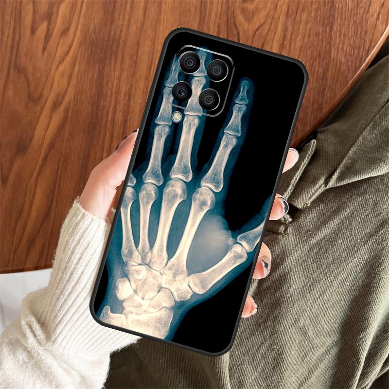 X-Ray Human Anatomy Case For Samsung Galaxy M11 M21 M31 M35 M12 M13 M14 M15 M16 M36 M56 M53 M32 M52 M55 M34 M54