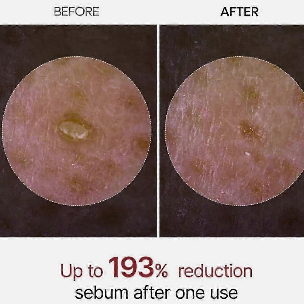 Dr.Melaxin PEEL SHOT GLOW EXFOLIANT KOJIC ACID TURMERIC SPRAY 80ml