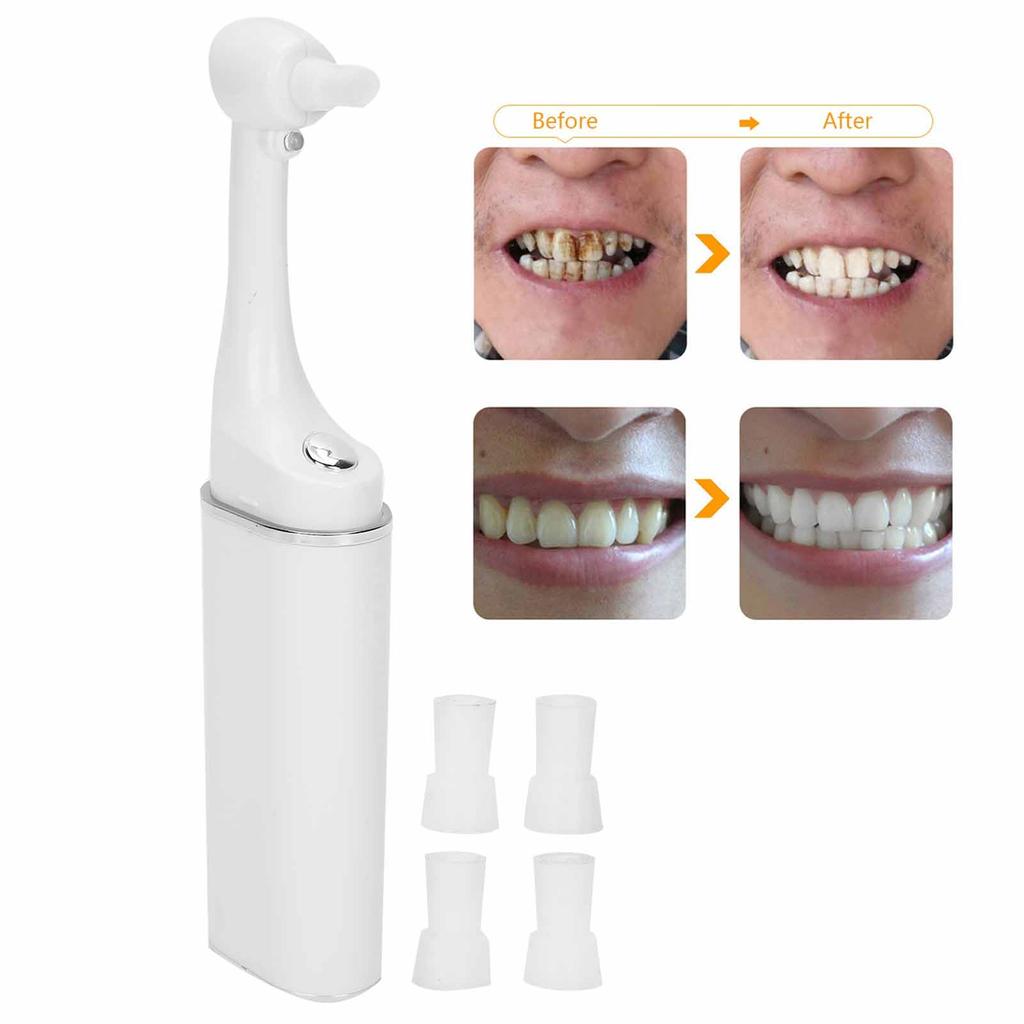 Electric Tooth Polisher Dental Stain Plaque Remover Teeth Whitening Cleaning Tool