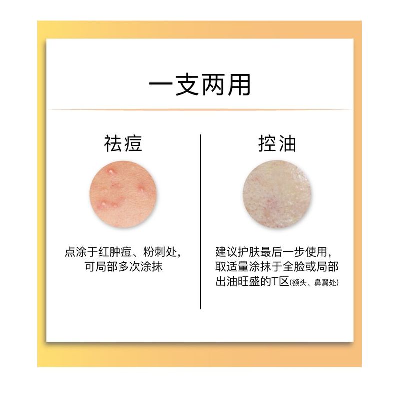 John Jeff - 20% Azelaic Acid Cream