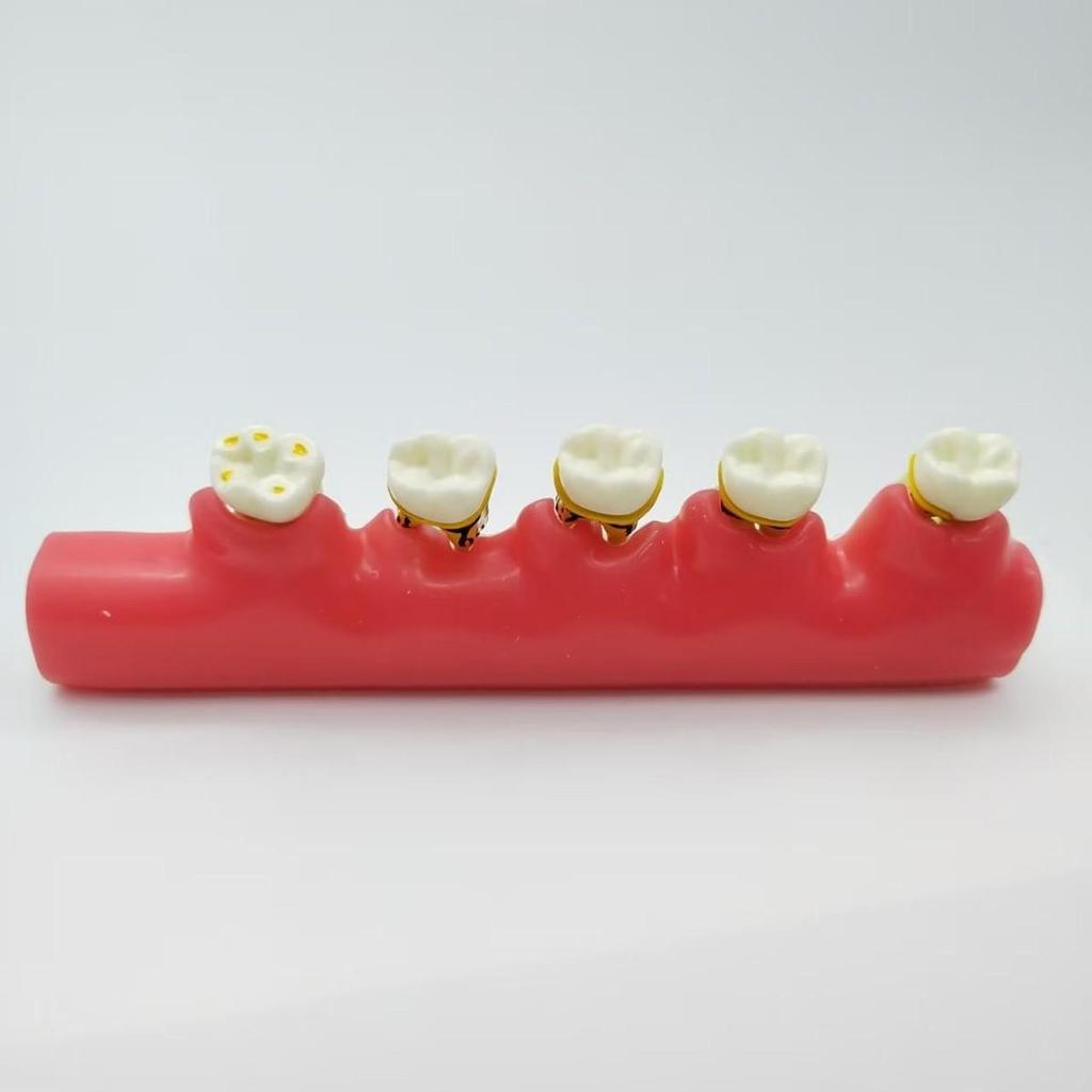 PH4010 Periodontal Classification Model: Dental Mold for Subgingival Calculus Scaling