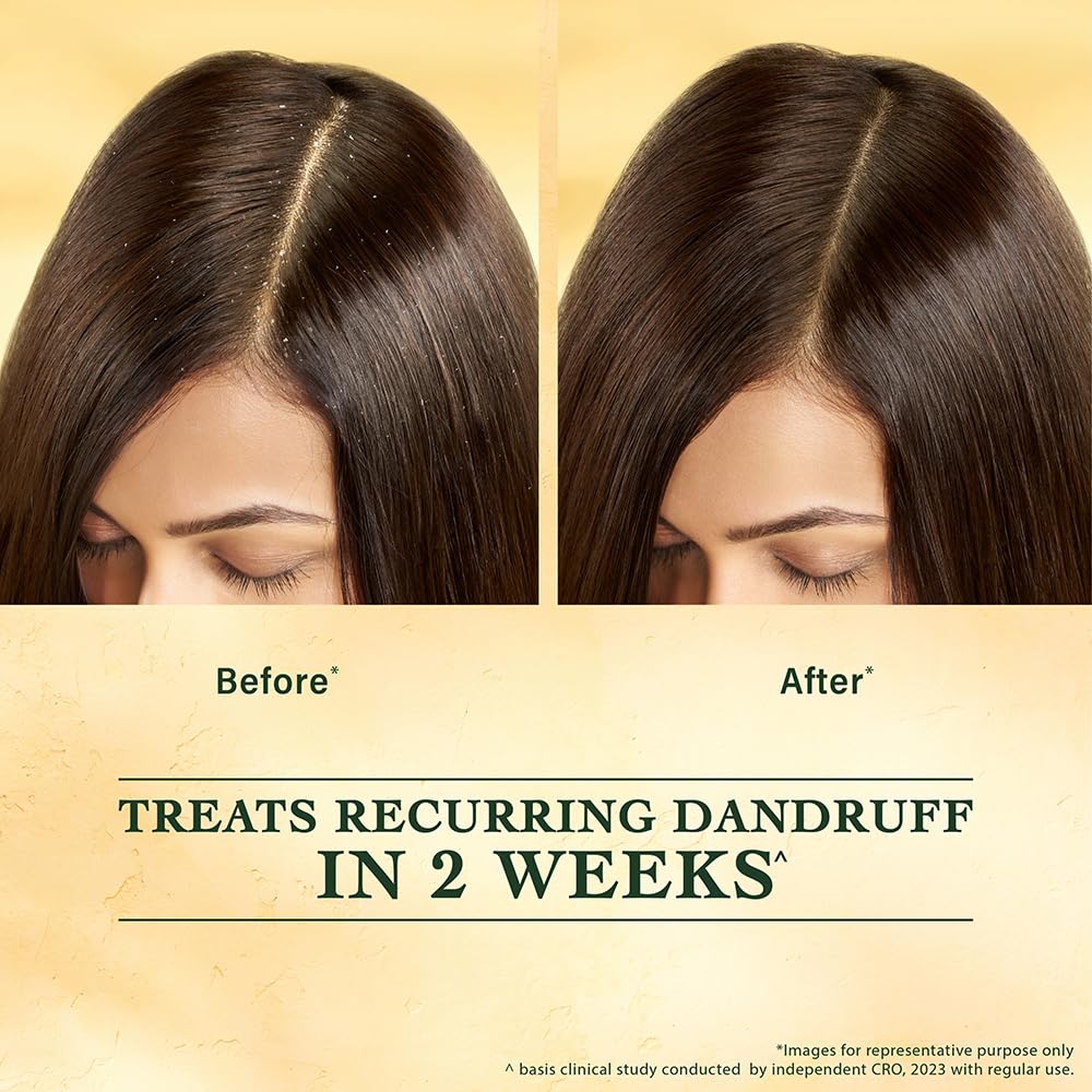 Indulekha Svetakutaja Anti Dandruff Scalp Serum 30ml | Ayurvedic Hair Care Solution For Itchy Scalp, Dryness Relief And Healthy Scalp Barrier Support