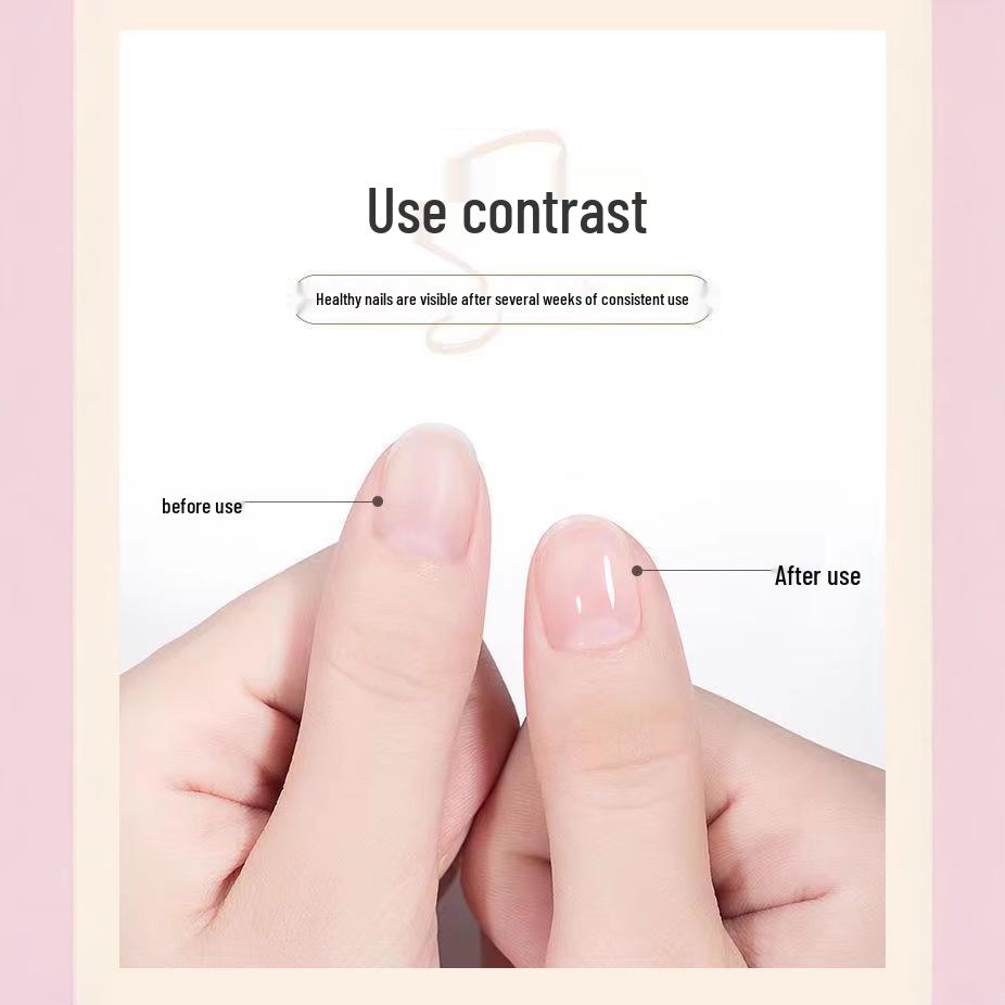 Cuticle & Nail Nourishing Oil Pen - Moisturizes, Repairs, and Exfoliates.